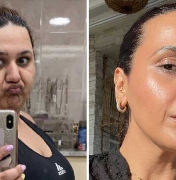 බර අඩු කර ගැනීමෙන් රෝග රැසක් සුව කරගත් ඩුබායි තරුණියකගේ කතාව..